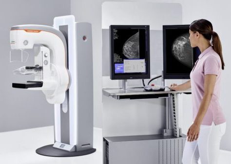 رادیولوژی دستگاه ماموگرافی